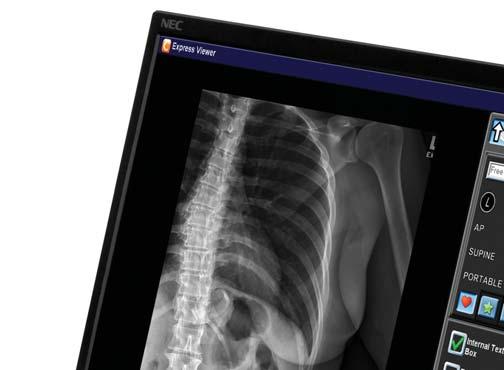 Fully Integrated Digital Radiography System DRX ACQUISITION CONSOLE Wide Screen touch-panel monitor X-ray Generator integration Preview image display within seconds