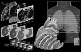 Tomographic Images Images of slices Eliminates anatomic superimposition Tomographic modalities