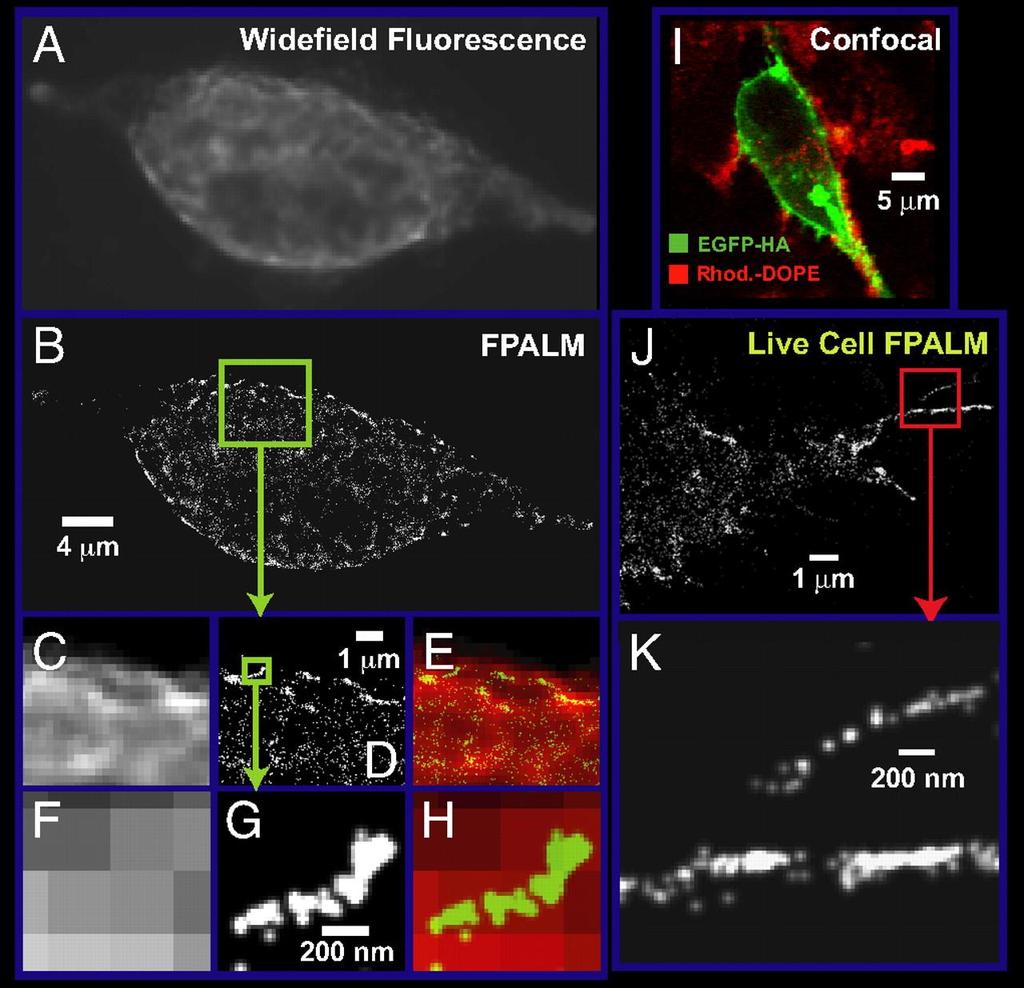 Nanoscale visualization of intracellular proteins by FPALM.