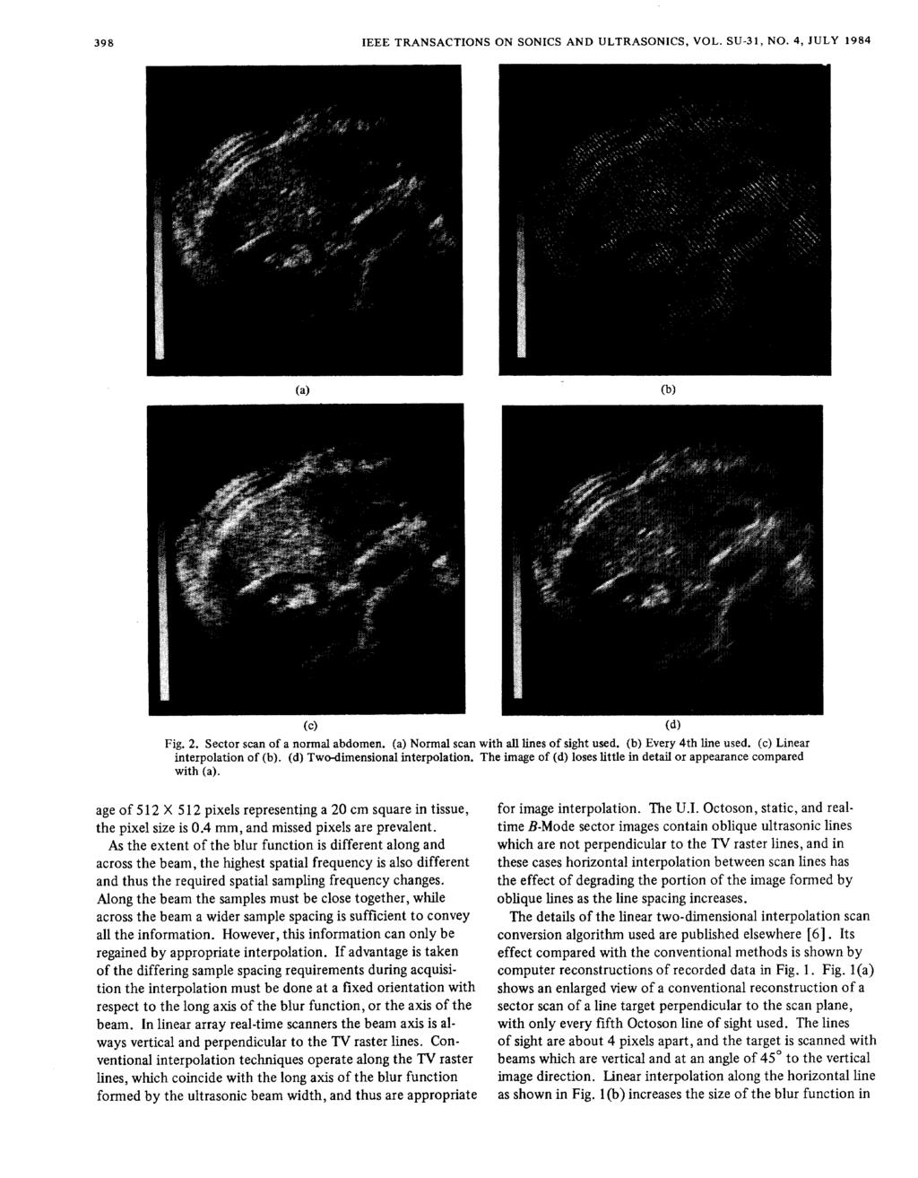 398 IEEE TRANSACTIONS ON SONICS AND ULTRASONICS, VOL. SU-31, NO. 4, JULY 1984 (C) (dl Pig. 2. Sector scan of a normal abdomen. (a) Normal scan with all lines of sight used. (b) Every 4th line used.