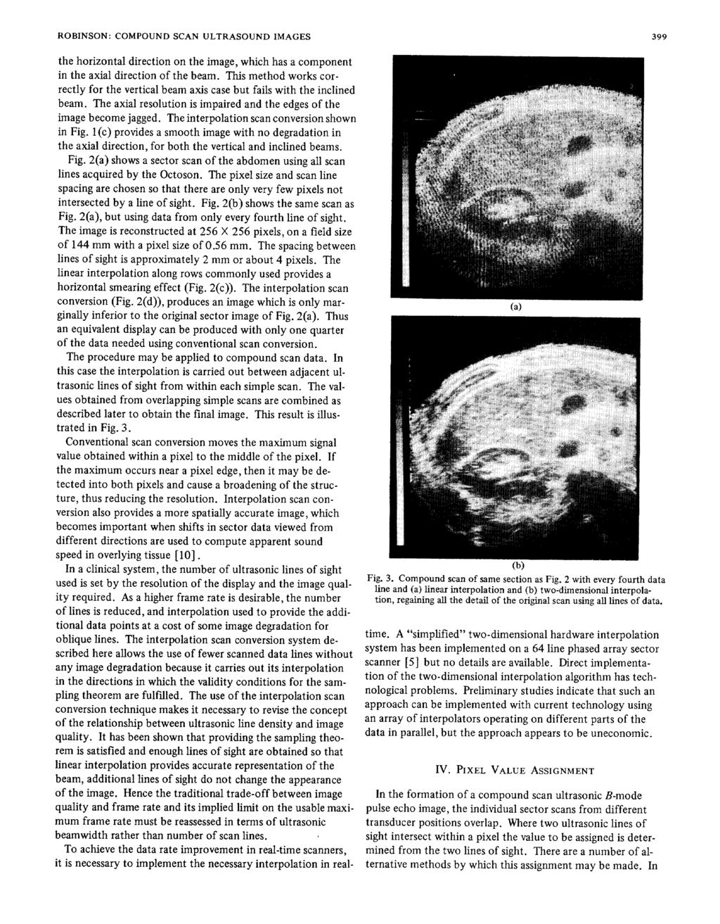 ROBINSON: COMPOUND SCAN ULTRASOUND IMAGES 399 the horizontal direction on the image, which has a component in the axial direction of the beam.