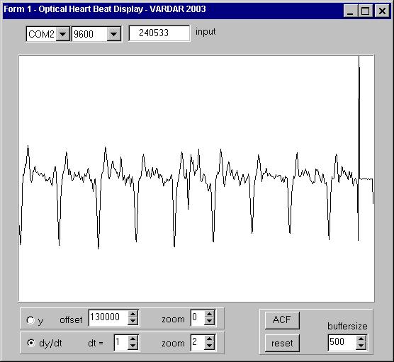 As seen in the above figure (see FIG 2.1) user has some settings, which also enables to see the original signal or the differentiated one.