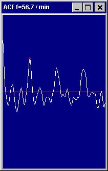 From the differentiated pulse signal the autocorrelation function is calculated. The strength of the function is that it is able to detect periodic parts hidden in a very noisy signal.