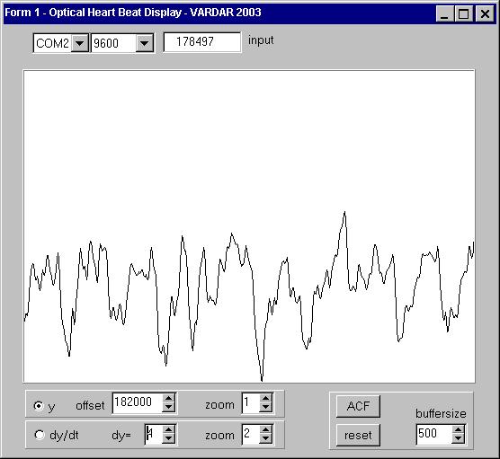 FIGURE 2.3 Pulse signal disturbed by high and low frequency noise (left) and corresponding autocorrelation function (right).