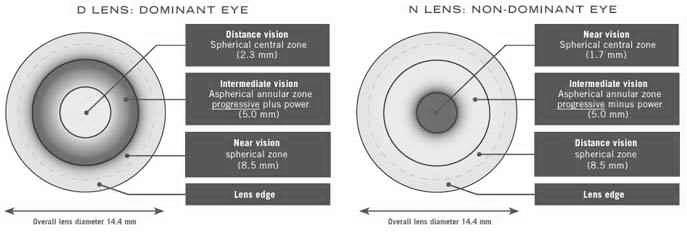 Know the lens specifics: CooperVision Biofinity Multifocal Oasys for Presbyopia Alternating