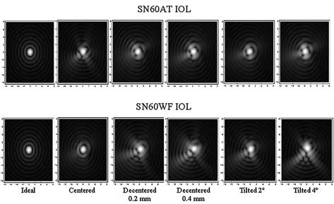 150 VISUAL SIMULATION IN MONOFOCAL IOLs ANALYSIS Figure 13. Variation of SN60WF intraocular lens (IOL) modulation transfer function (MTF) for all IOL positions studied.