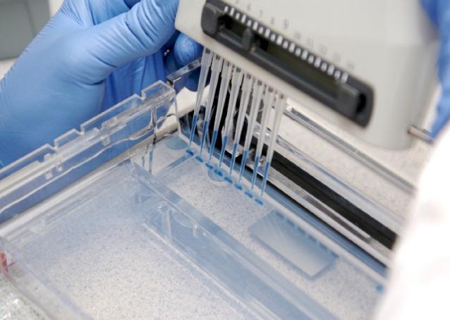 Gel Electrophoresis After a sequence, such as an STR, has been amplified through PCR, it must then be measured before it can be analyzed for matches to samples from suspects or victims.