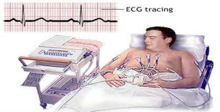 ECG Recording o It uses several electrodes o The machine