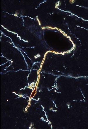 examples of applications Glia (red) and neurons (green) are visible in a dog hippocampus slice....with friendly permission of Gloria E.