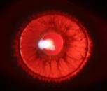 noted off of the fundus Flash Setting HIGH Magnification 10