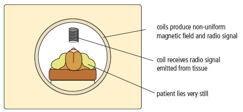 NMR Nuclear Magnetic Resonance / MRI Magnetic Resonance Imaging Using a non-uniform magnetic
