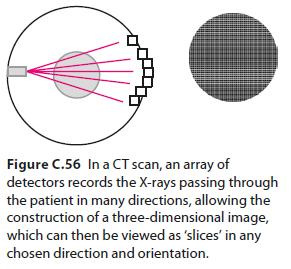 X-rays - Tomography CT (computer tomography ) or CAT (computer-assisted tomography) made possible better diagnosis with a less