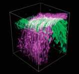 Deep imaging with highly efficient optics dedicated to multiphoton imaging The SHG (Second Harmonic Generation) image of the brain surface of a mouse imaging gallery The neocortex of an