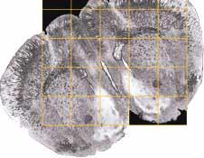 3D Mosaic Imaging Mosaic imaging is performed using a high-magnification objective to acquire continuous 3D (XYZ) images of adjacent fields of view using the motorized stage, utilizing proprietary