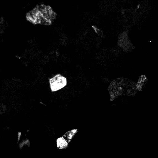 In the BF image (left), some crystals appear with dark contrast since they are oriented (almost) parallel to a zone axis (Bragg contrast).
