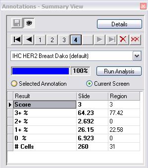 ImageScope Annotations Annotations Summary View Provides a streamed line view of the annotations window. Developed for analyzing DIHC slides.