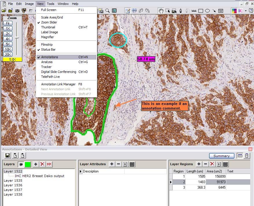 ImageScope Image Analysis Select Area to Analyze Analyze an entire digital