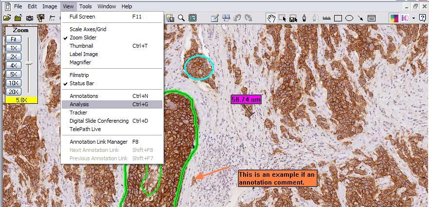 ImageScope Image Analysis Perform Analysis Select analysis tool to use with a slide through the Analysis window.