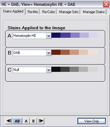 Image Quality Features IQ Features View a selected stain while navigating the slide. IQ uses color deconvolution to separate stains and present them as you pan or scroll about the image.