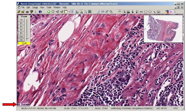 Image Quality Stain Sets IQ Use With Any Stain Set To use IQ user must open an image in ImageScope through Spectrum Plus.