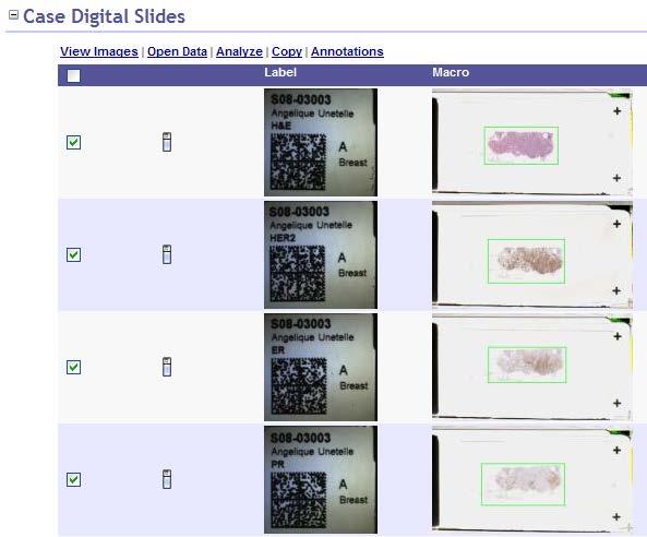 ImageScope Basic Features Open Digital Slides Open a single digital slide or multiple slides from