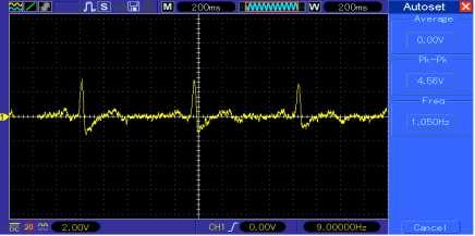 Fig 3.1: ECG waveform recorded without connecting RL Drive Fig 3.