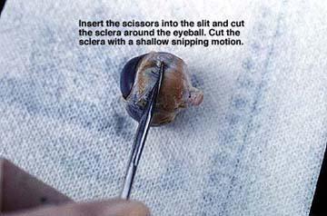 7. Insert the point of the scissors into the slit made by the probe and cut the sclera with a shallow snipping motion. Turn the eye as you continue the cutting action.