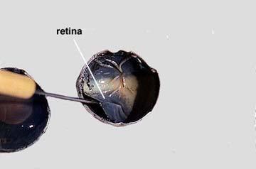 Retina: tissue in the back of the eye where light is focused.