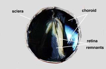 9. Use your forceps to peel the retina away from the underlying choroid coat. The retina should remain attached at the blind spot. The choroid coat is dark and relatively thin.