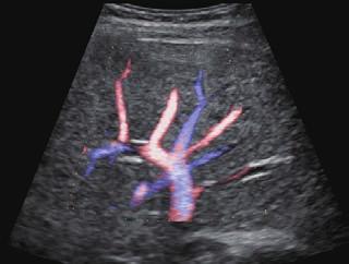 of the thyroid gland Trapezoidal imaging of a