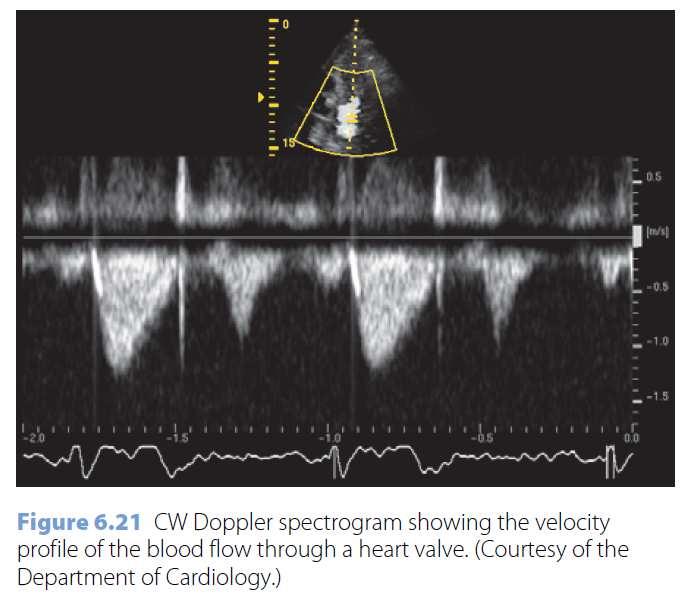 Doppler imaging To visualize velocities of moving tissues 3 different data acquisition methods 1) Continuous wave (CW) Doppler Two crystal for transmitting continuous sinusoidal wave and detecting in