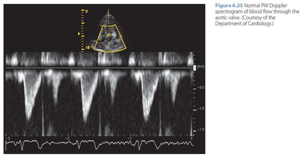 samples of a slowly time-varying sinusoidal function with frequency R = T U 21 CF imaging