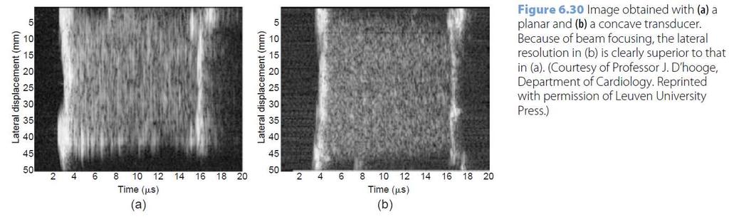 Noise & contrast Noise Due to scatter reflections, called speckle noise However, the speckle pattern enables the user to distinguish different tissues from each other Contrast Echogenic structures