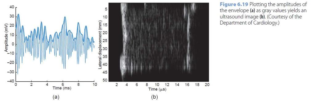 band signal for the second harmonic imaging 15 Envelope detection To remove high-freq.