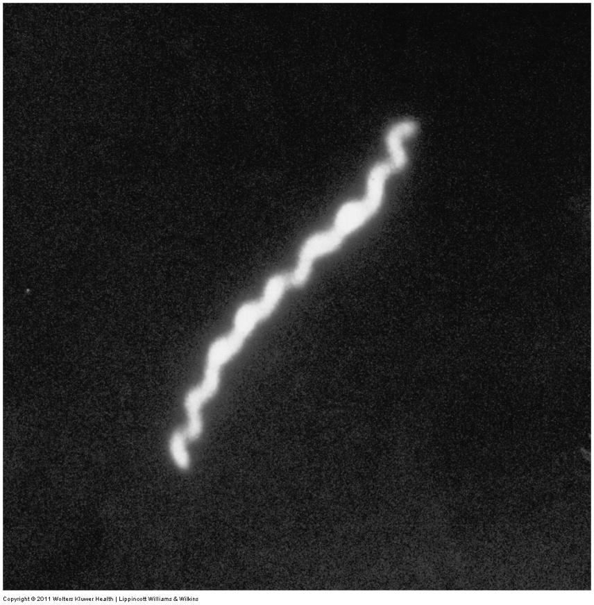 Darkfield Microscopy of Treponemapallidum (the bacterium that causes syphilis) Phase