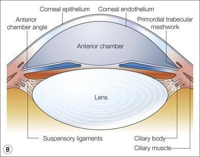 Fig 4: The Anterior Chamber. The iris (Fig 5)is made up of muscles, blood vessels and pigmented cells. It has a central circular opening through which light travels, known as the pupil (Fig 5).