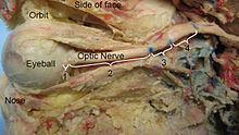 Fig 14: The Optic nerve seen passing from the back of the eye into the cranial cavity.