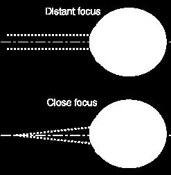 The Lens Lens: Transparent structure behind the pupil that changes shape to focus images on the retina.