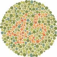 Color Blindness- usually caused by a cone