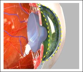 6) Cornea The clear, transparent front layer of the eye through which light passes is called the cornea. It covers both the pupil and the iris.