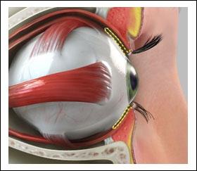 This layer is in continuity with the cornea and the dura of the central nervous system. (Fig. 8) (Refer fig.