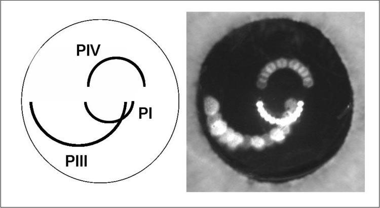 IOVS, October 2006, Vol. 47, No. 10 Optical Performance of Eyes with IOLs 4655 FIGURE 6. Example of one of the images recorded with the Purkinje meter.