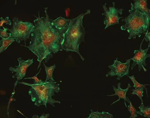 Figure 1 Pseudocolor composite image of triple-labeled cells acquired with ImageXpress.