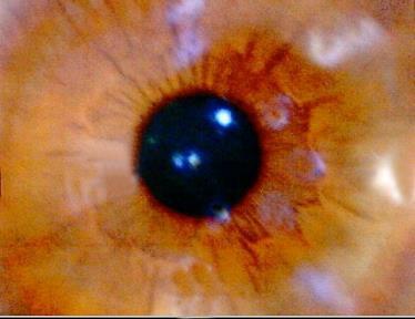 The Human Retina The eye