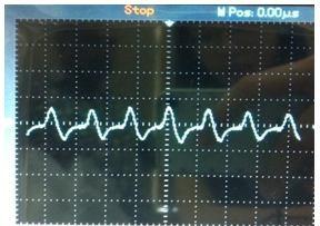 Fiber optic PPG signals acquired after testing: Results are compatible with other PPG signals from current available heart rate monitor.