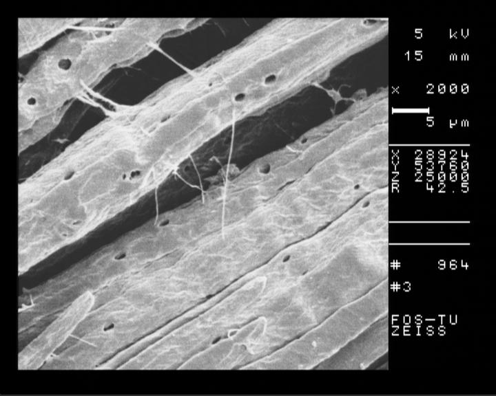 Fig.17B. SEM of canola paper at Kappa: 43 with DEG pulping CONCLUSIONS 1.