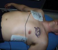 Research background For emergency, electric shock is applied for defibrillation Not high success rate The optimum size, location of electrolodes are unknown and depends on age and sex. a http://www.
