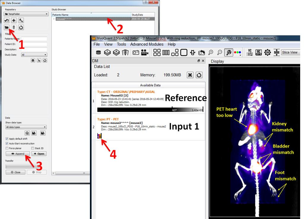 Importing a PET DICOM Dataset for Image Co-registration with MicroCT 1. In the VivoQuant Data Browser window, click Open local folder and select the PET data folder as shown in Figure 8. 2.
