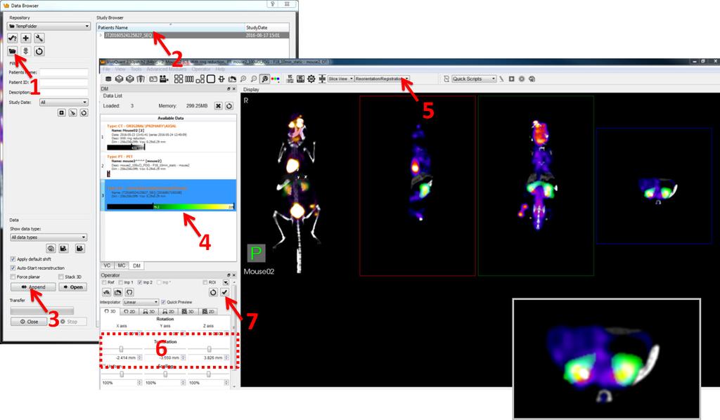 Adding and Adjusting the FLIT DICOM Dataset to the Co-registrated PET/CT Image 1. Click the Open local folder button to search for the FLIT DICOM folder. 2.