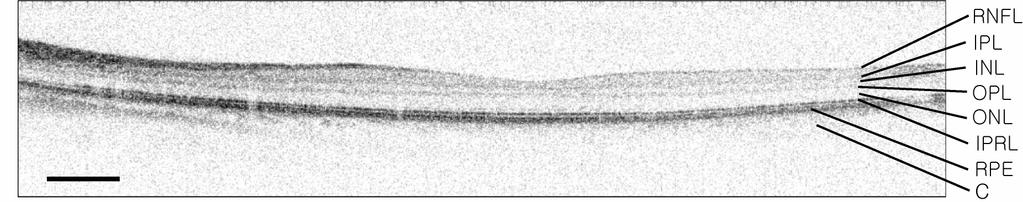 Fig. 5. Macular region, 6.4 mm wide X 1.4 mm deep (in tissue). Scale bar, 500 µm. RNFL: retinal nerve fiber layer. IPL: inner plexiform layer. INL: inner nuclear layer. OPL: outer plexiform layer.